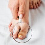Kako učinkovito odpravite glivice na nohtih